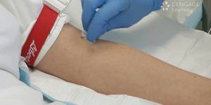 Venipuncture